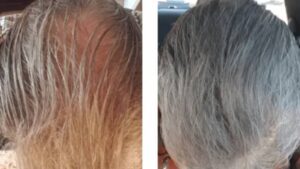 Top Trichologist: Do This To Your Scalp To Regrow A Full Head Of Hair